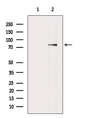 WB analysis of Raji whole cell lysate using GTX04615 SLC26A5 antibody. The lane on the left was treated with blocking peptide.