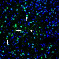 IHC (Free floating) analysis of rat brain tissue using GTX04619 Pannexin 1 antibody. PANX1 staining is apparent in cells with neuronal outline (vertical arrows) and apical dendrites (horizontal arrows) in the parietal cingulated cortex region. Green : Primary antibody Blue : DAPI IHC (Free floating) analysis of rat brain tissue using GTX04619 Pannexin 1 antibody. PANX1 staining is apparent in cells with neuronal outline (vertical arrows) and apical dendrites (horizontal arrows) in the parietal cingulated cortex region. Green : Primary antibody Blue : DAPI