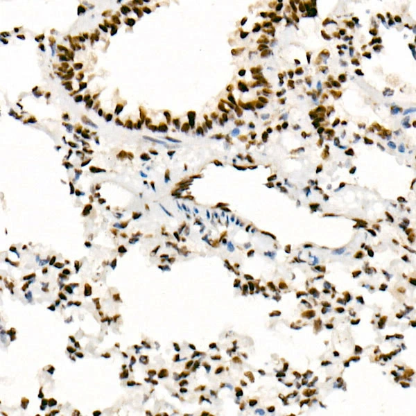 IHC-P analysis of rat lung tissue using GTX04623 SNF5 antibody [ARC53139]. Antigen retrieval : 10 mM Tris/EDTA buffer pH 9.0 Dilution : 1:100
