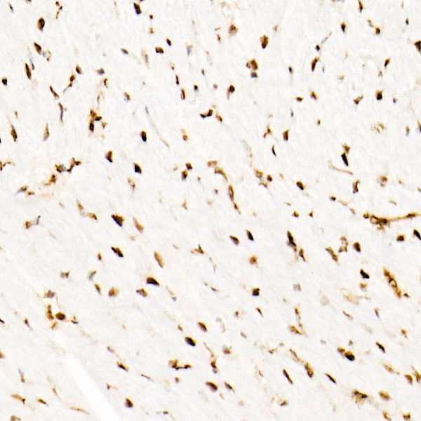 IHC-P analysis of mouse heart tissue using GTX04623 SNF5 antibody [ARC53139]. Antigen retrieval : 10 mM Tris/EDTA buffer pH 9.0 Dilution : 1:100