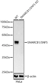 WB analysis of HeLa cells with/without KD treatment using GTX04623 SNF5 antibody [ARC53139]. Loading : 25 microg Dilution : 1:2000