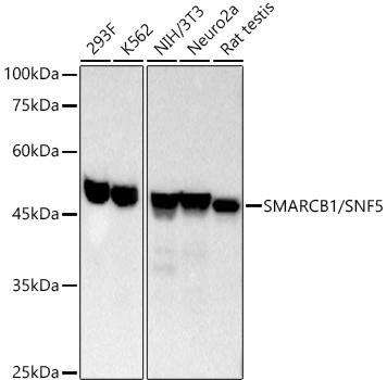 WB analysis of various samples using GTX04623 SNF5 antibody [ARC53139]. Loading : 25 microg Dilution : 1:10000
