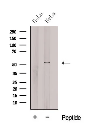 WB analysis of HeLa whole cell lysate using GTX04624 C6ORF150 antibody. The lane on the left was treated with blocking peptide. WB analysis of HeLa whole cell lysate using GTX04624 C6ORF150 antibody. The lane on the left was treated with blocking peptide.