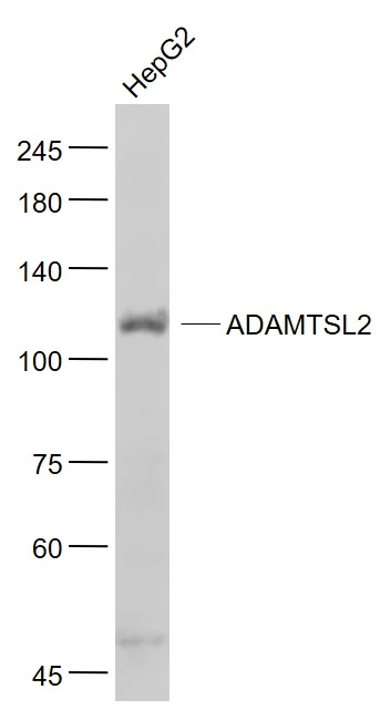 WB analysis of HepG2 whole cell lysate using GTX04625 ADAMTSL2 antibody. Dilution : 1:1000 WB analysis of HepG2 whole cell lysate using GTX04625 ADAMTSL2 antibody. Dilution : 1:1000