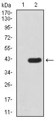WB analysis of HEK293 cells overexpressed with/without FBXL10 (AA: 457-555)-hIgGFc using GTX04628 FBXL10 antibody [6F6G11].