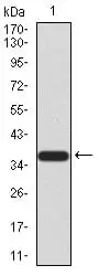 WB analysis of human FBXL10 (AA: 457-555) recombinant protein using GTX04628 FBXL10 [6F6G11].