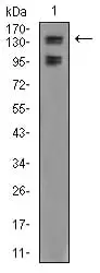 WB analysis of A549 whole cell lysate using GTX04628 FBXL10 antibody [6F6G11].