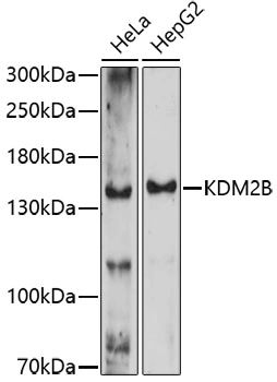 WB analysis of various cell lysates using GTX04629 FBXL10 antibody. Loading : 25 microg Dilution : 1:1000 WB analysis of various cell lysates using GTX04629 FBXL10 antibody. Loading : 25 microg Dilution : 1:1000