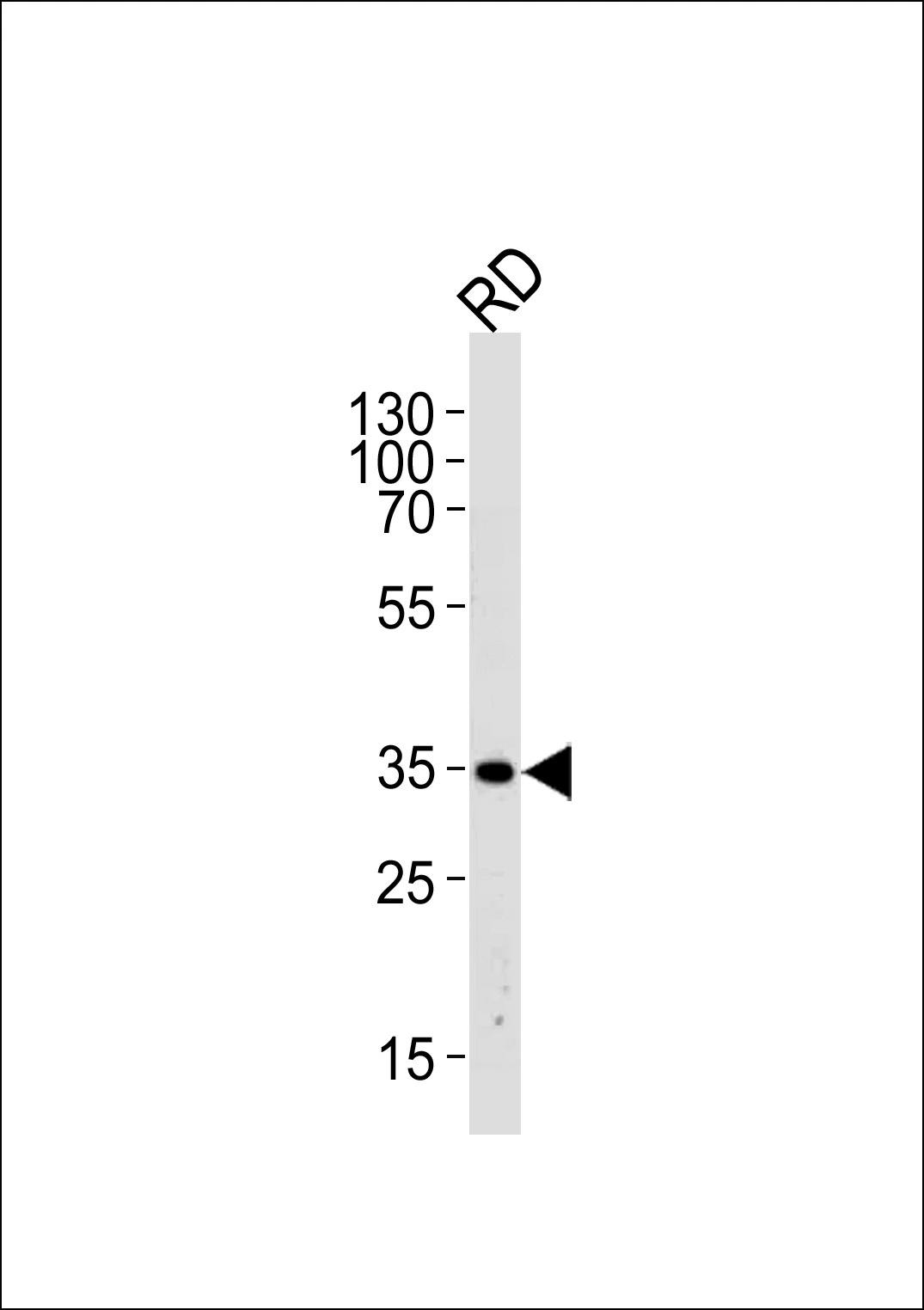 WB analysis of RD whole cell lysate using GTX04634 EDA antibody. Loading : 35 microg Dilution : 1:1000