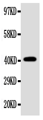 WB analysis of SW620 whole cell lysate using GTX04635 EDA antibody. WB analysis of SW620 whole cell lysate using GTX04635 EDA antibody.