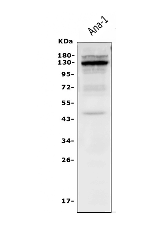 WB analysis of ANA-1 whole cell lysate using GTX04641 IL3 Receptor beta antibody. Loading : 50 microg Dilution : 0.5 microg/mL