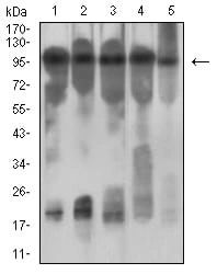 WB analysis of various samples using GTX04642 IL3 Receptor beta antibody [1D5E4]. Lane 1 : NIH-3T3 whole cell lysate Lane 2 : HeLa whole cell lysate Lane 3 : C6 whole cell lysate Lane 4 : A549 whole cell lysate Lane 5 : MCF-7 whole cell lysate