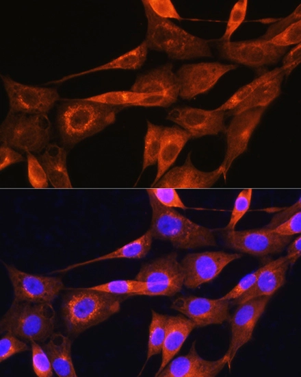 ICC/IF analysis of NIH-3T3 cells using GTX04661 Apolipoprotein A2 antibody. Orange : Primary antibody Blue : DAPI Dilution : 1:100 ICC/IF analysis of NIH-3T3 cells using GTX04661 Apolipoprotein A2 antibody. Orange : Primary antibody Blue : DAPI Dilution : 1:100