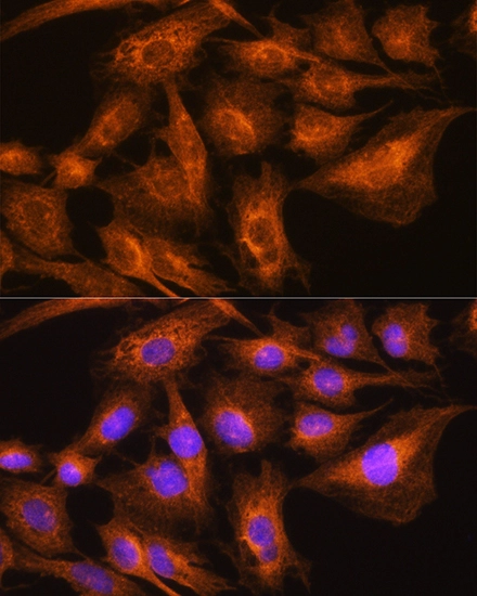 ICC/IF analysis of C6 cells using GTX04661 Apolipoprotein A2 antibody. Orange : Primary antibody Blue : DAPI Dilution : 1:100