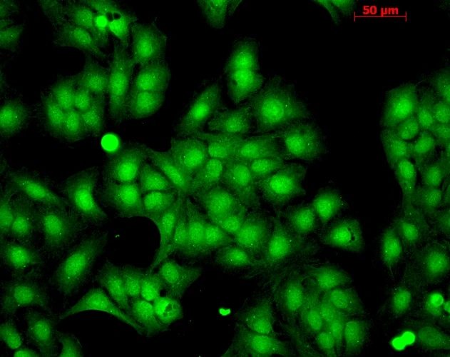ICC/IF analysis of cold 100% methanol-fixed HaCaT cells using GTX04663 HSP22 antibody. Dilution : 1:100 ICC/IF analysis of cold 100% methanol-fixed HaCaT cells using GTX04663 HSP22 antibody. Dilution : 1:100