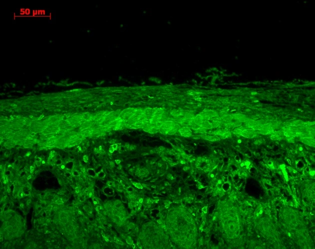IHC-P analysis of mouse backskin tissue using GTX04663 HSP22 antibody. Localization : Epidermis positive, dermal staining. Fixation: Bouins Fixative Solution. Dilution : 1:100