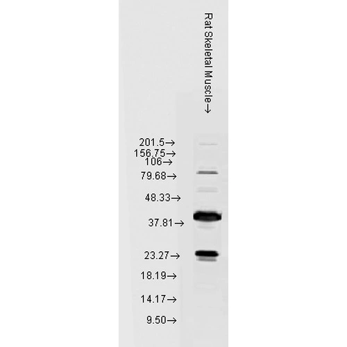 WB analysis of rat skeletal muscle tissue lysate using GTX04663 HSP22 antibody. Loading : 15 microg Dilution : 1:1000