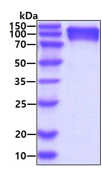 SDS-PAGE analysis of GTX04666-pro Human CD66e protein, His tag. Loading : 3 microg SDS-PAGE analysis of GTX04666-pro Human CD66e protein, His tag. Loading : 3 microg