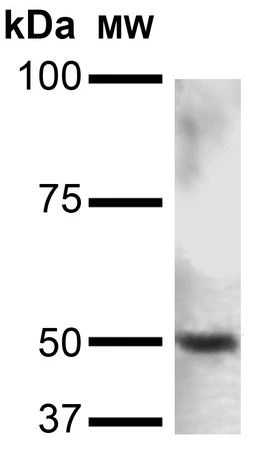 WB analysis of rat brain tissue lysate using GTX04667 PINK1 antibody [S4-15]. Loading : 15 microg Dilution : 1:200