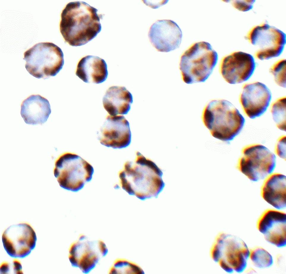 IHC-P (cell pellet) analysis of K562 cells using GTX04669 TRPC6 antibody. Dilution : 2 microg/mL