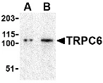 WB analysis of K562 whole cell lysate using GTX04669 TRPC6 antibody. Lane 1 : 0.5 microg/mL Lane 2 : 1 microg/mL