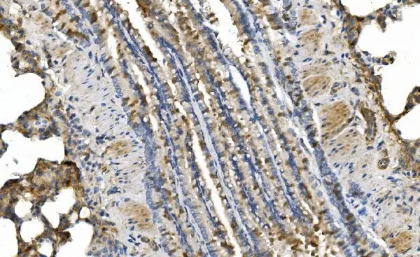 IHC-P analysis of rat lung tissue using GTX04678 cGK1 antibody. Antigen retrieval : Heat mediated EDTA buffer (pH 8.0) Dilution : 2 microg/mL