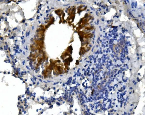IHC-P analysis of mouse lung tissue using GTX04678 cGK1 antibody. Antigen retrieval : Heat mediated EDTA buffer (pH 8.0) Dilution : 2 microg/mL