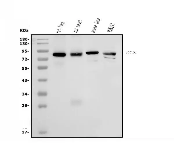 WB analysis of various samples using GTX04678 cGK1 antibody. Loading : 50 microg Dilution : 0.5 microg/mL