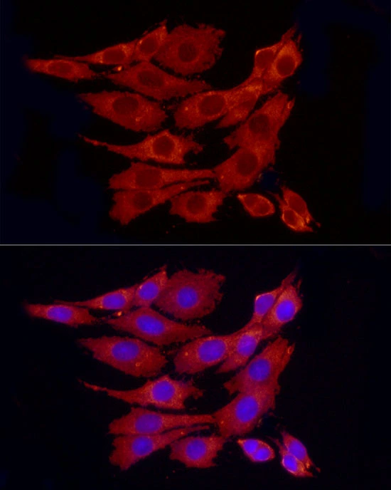 ICC/IF analysis of PC-12 cells using GTX04684 PPP1A antibody. Orange : Primary antibody Blue : DAPI Dilution : 1:100 ICC/IF analysis of PC-12 cells using GTX04684 PPP1A antibody. Orange : Primary antibody Blue : DAPI Dilution : 1:100