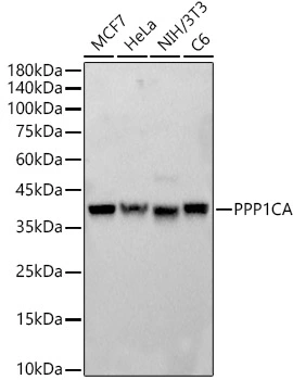 WB analysis of various samples using GTX04684 PPP1A antibody. Loading : 25 microg Dilution : 1:800