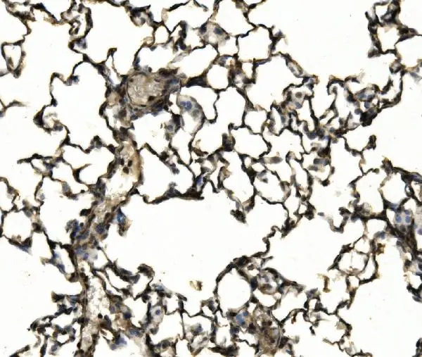 IHC-P analysis of rat lung tissue using GTX04685 CD11c antibody. Antigen retrieval : Heat mediated EDTA buffer (pH 8.0) Dilution : 2 microg/mL IHC-P analysis of rat lung tissue using GTX04685 CD11c antibody. Antigen retrieval : Heat mediated EDTA buffer (pH 8.0) Dilution : 2 microg/mL