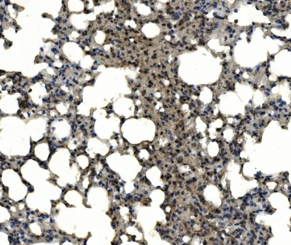IHC-P analysis of mouse lung tissue using GTX04685 CD11c antibody. Antigen retrieval : Heat mediated EDTA buffer (pH 8.0) Dilution : 2 microg/mL