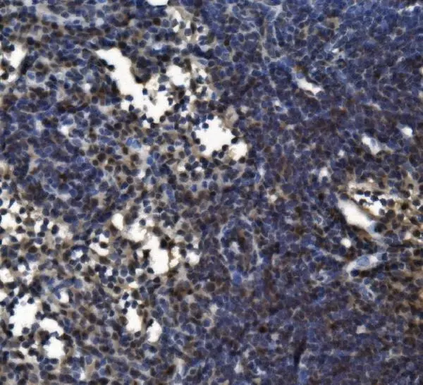 IHC-P analysis of rat lymph node tissue using GTX04685 CD11c antibody. Antigen retrieval : Heat mediated EDTA buffer (pH 8.0) Dilution : 2 microg/mL