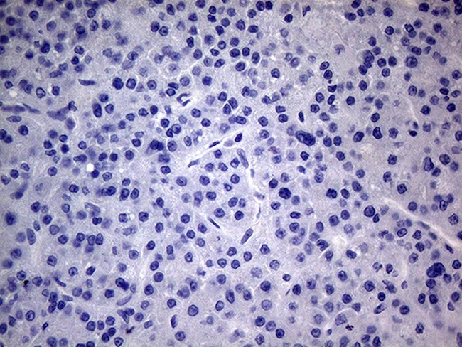 IHC-P analysis of human liver tissue using GTX04688 PMP22 antibody [OTI5D1]. This figure shows negative staining. Antigen retrieval : Heat mediated 1mM EDTA in 10mM Tris buffer (pH 8.5) Dilution : 1:2000