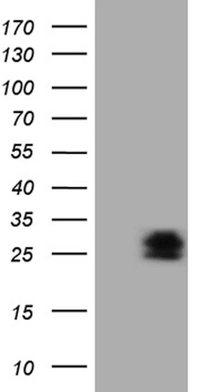 WB analysis of 293T cells with/without human PMP22 protein transfection using GTX04688 PMP22 antibody [OTI5D1]. Lane 1 : Control vector Lane 2 : Human PMP22 transfection Loading : 5 microg
