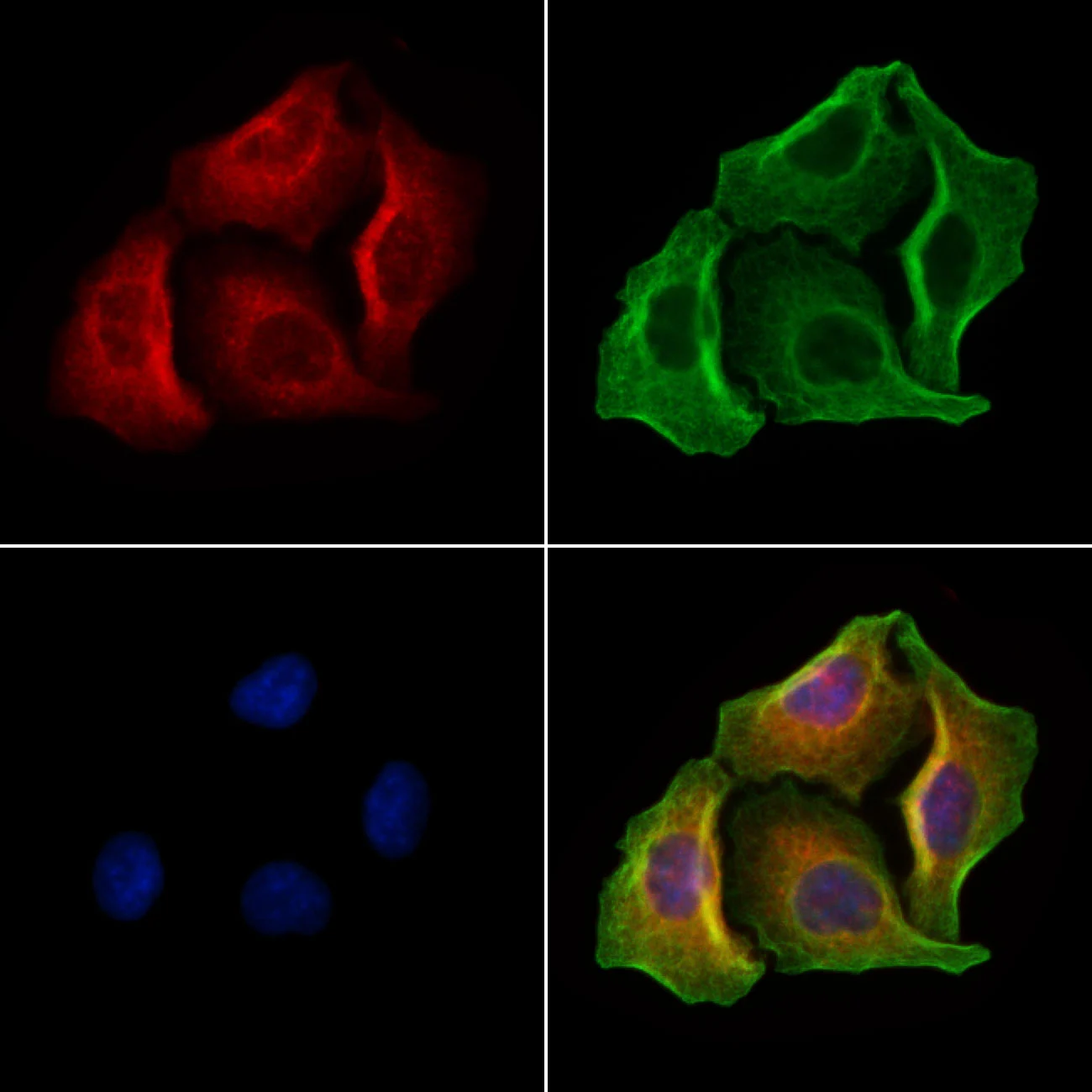 ICC/IF analysis of PFA-fixed HeLa cells with LPS-treatment using GTX04690 Gasdermin D antibody. Red : Primary antibody Green : Beta tubulin Blue : DAPI Permeabilization : 0.1% Triton X-100 Dilution : 1:200 ICC/IF analysis of PFA-fixed HeLa cells with LPS-treatment using GTX04690 Gasdermin D antibody. Red : Primary antibody Green : Beta tubulin Blue : DAPI Permeabilization : 0.1% Triton X-100 Dilution : 1:200