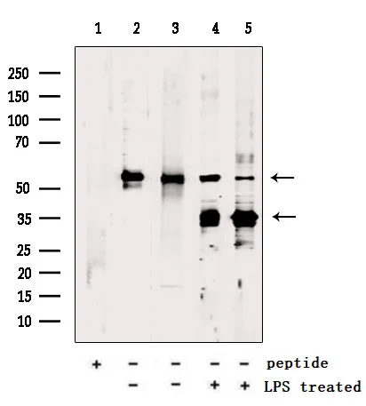 WB analysis of various samples using GTX04690 Gasdermin D antibody. Lane 1 : TPA + LPS treated C6 whole cell lysate with blocking peptide Lane 2 : TPA-treated C6 whole cell lysate Lane 3 : TPA-treated HepG2 whole cell lysate Lane 4 : TPA + LPS treated C6 whole cell lysate Lane 5 : TPA + LPS treated HepG2 whole cell lysate
