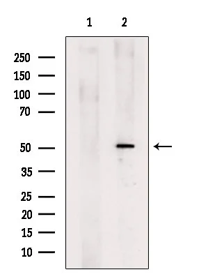 WB analysis of B16F10 whole cell lysate using GTX04690 Gasdermin D antibody. The lane on the left was treated with blocking peptide.