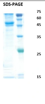 SDS-PAGE analysis of GTX04691-pro Dengue virus type 4 Envelope protein. SDS-PAGE analysis of GTX04691-pro Dengue virus type 4 Envelope protein.