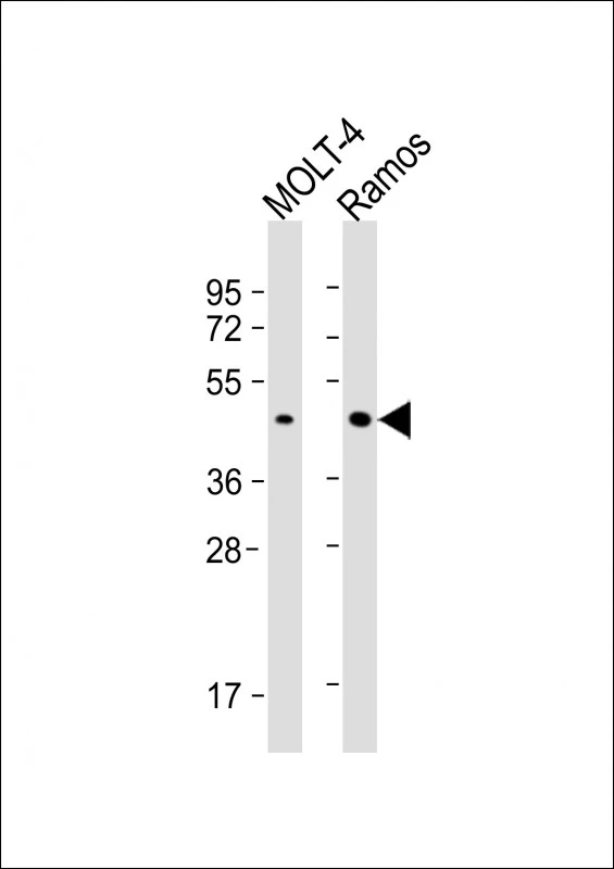 WB analysis of various samples using GTX04695 BCAT1 antibody. Loading : 20 microg Dilution : 1:1000