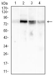 WB analysis of various samples using GTX04701 CD79a antibody [4A10D12]. Lane 1 : Raji whole cell lysate Lane 2 : Ramos whole cell lysate Lane 3 : K562 whole cell lysate Lane 4 : Molt-4 whole cell lysate