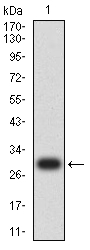 WB analysis of human CD79a (aa 33-143) recombinant protein using GTX04701 CD79a antibody [4A10D12].