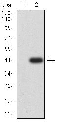WB analysis of HEK293 cells with/without CD79a (aa 33-143)-hIgGFc overexpression using GTX04701 CD79a antibody [4A10D12].