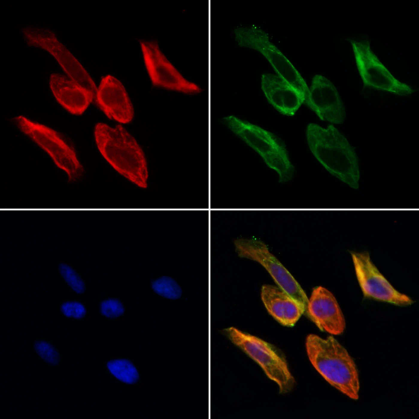 ICCIF analysis of PFA-fixed HeLa cells using GTX04723 GGT1 antibody. Red : Primary antibody Green : Beta tubulin Blue : DAPI Permeabilization : 0.1% Triton X-100 ICCIF analysis of PFA-fixed HeLa cells using GTX04723 GGT1 antibody. Red : Primary antibody Green : Beta tubulin Blue : DAPI Permeabilization : 0.1% Triton X-100