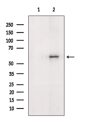 WB analysis of mouse myeloma cells using GTX04723 GGT1 antibody. The lane on the left was treated with blocking peptide.
