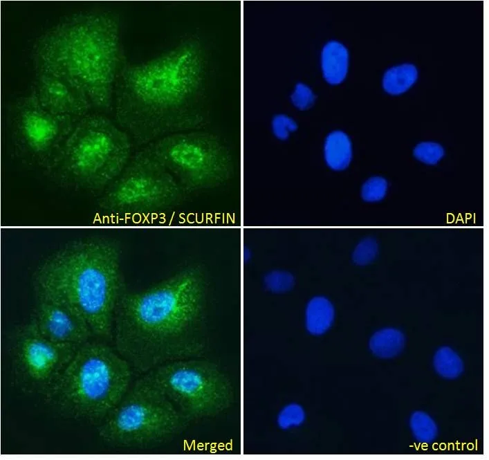 ICC/IF analysis of PFA-fixed U2OS cells using GTX04725 FOXP3 antibody. Green : Primary antibody Blue : DAPI Permeabilization : 0.15% Triton Dilution : 10 microg/mL