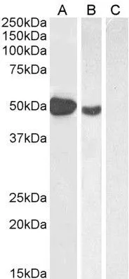 WB analysis of various samples using GTX04725 FOXP3 antibody. Lane A : Human muscle tissue lysate Lane B : Molt-4 whole cell lysate Lane C : Human pancreas tissue lysate (negative control) Dilution : 1 microg/mL
