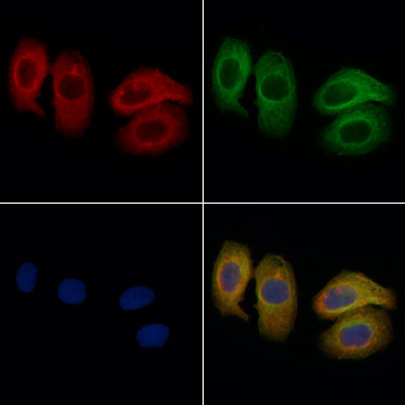 ICC/IF analysis of PFA-fixed HeLa cells using GTX04729 Fc epsilon R1 alpha antibody. Red : Primary antibody Green : Beta tubulin Blue : DAPI Permeabilization : 0.1% Triton X-100 Dilution : 1:200 ICC/IF analysis of PFA-fixed HeLa cells using GTX04729 Fc epsilon R1 alpha antibody. Red : Primary antibody Green : Beta tubulin Blue : DAPI Permeabilization : 0.1% Triton X-100 Dilution : 1:200