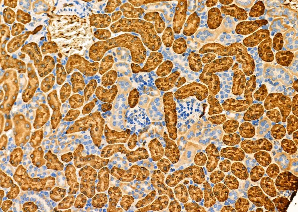 IHC-P analysis of mouse kidney tissue using GTX04729 Fc epsilon R1 alpha antibody. Antigen retrieval : Heat mediated citrate buffer Dilution : 1:100