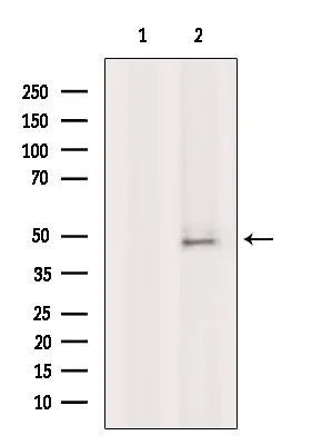 WB analysis of rat liver tissue lysate using GTX04729 Fc epsilon R1 alpha antibody. The lane on the left was treated with blocking peptide.